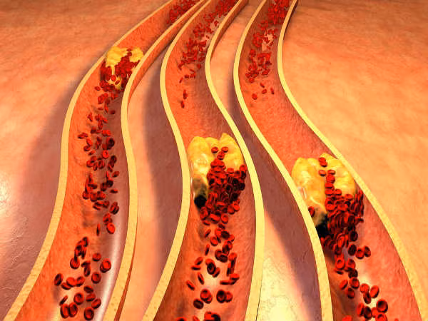 Bạn không thể sống thiếu cholesterol bởi các hormone và tế bào của cơ thể cần nó để hoạt động bình thường. Nó còn được gọi là khối xây dựng cho tất cả các tế bào của cơ thể.
