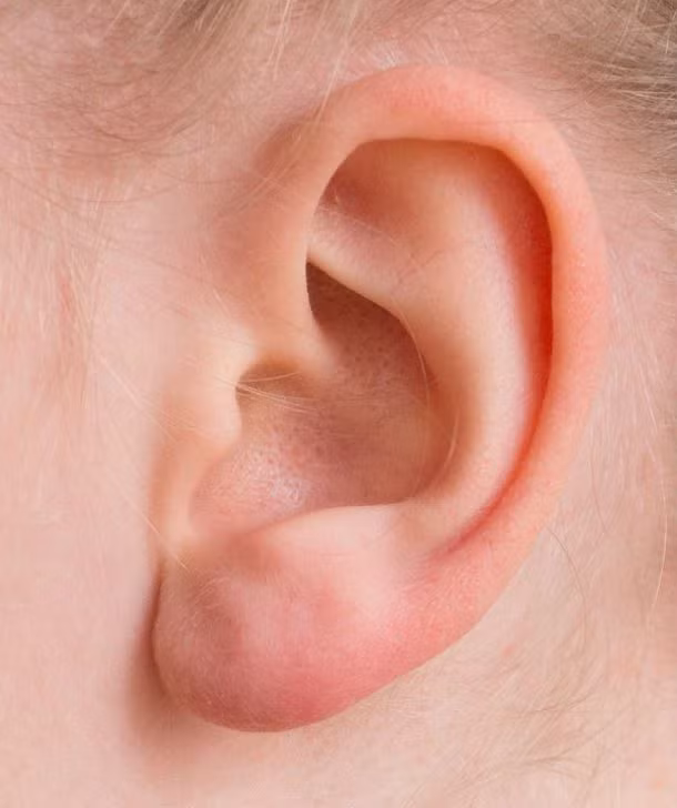 Giác quan cuối cùng ngừng hoạt động khi bạn chết được cho là thính giác.