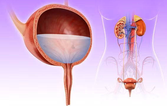 Khi bạn bị nhiễm khuẩn đường tiết niệu, nước tiểu sẽ có màu đỏ nhẹ hoặc có máu trong nước tiểu. Khi thấy nước tiểu có dấu hiệu bị đục, có máu, bạn cần đi khám ngay lập tức.