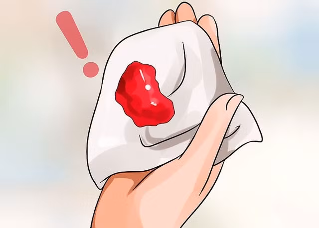 Lượng máu tiết ra nhiều hơn trong chu kỳ kinh nguyệt hay sau khi quan hệ... đi kèm với đó là hiện tượng máu đỏ tươi, lúc ra lúc không kéo dài cũng là một trong các dấu hiệu tiềm ẩn của bệnh ung thư cổ tử cung.