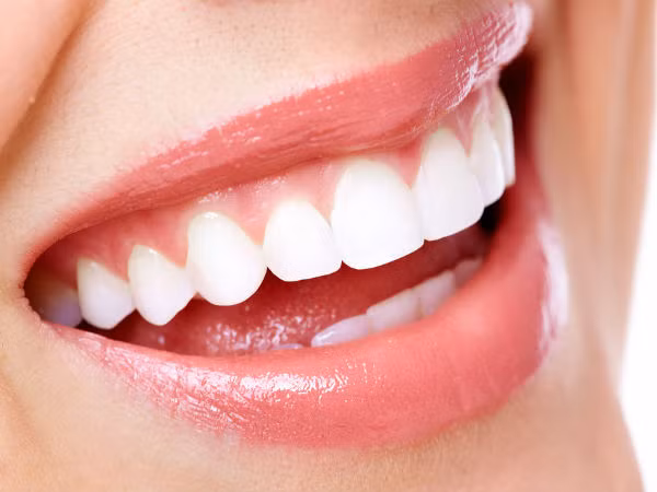 Uống trà vào buổi sáng có thể làm xói mòn răng. Điều này xảy ra vì vi khuẩn trong miệng sẽ phá vỡ đường, làm tăng nồng độ axit trong miệng gây ra sự ăn mòn của men răng.