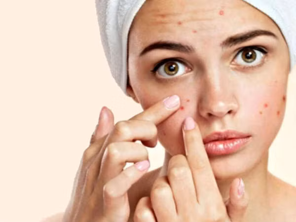Chế độ ăn ít đường có thể ngăn ngừa hoặc cải thiện tình trạng mặt mọc mụn trứng cá. Theo nghiên cứu được công bố trên Tạp chí của Học viện Da liễu Mỹ, các nhà nghiên cứu phát hiện ra rằng một chế độ ăn ít đường, có hàm lượng protein cao có thể giúp kiềm chế mụn trứng cá ở nam giới.