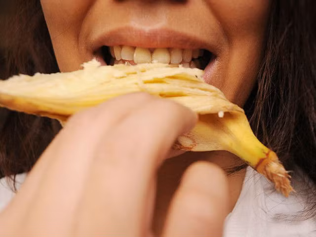 Làm trắng răng: Chà phần bên trong của vỏ chuối lên răng vài lần/tuần, răng của bạn sẽ sáng lên trông thấy.
