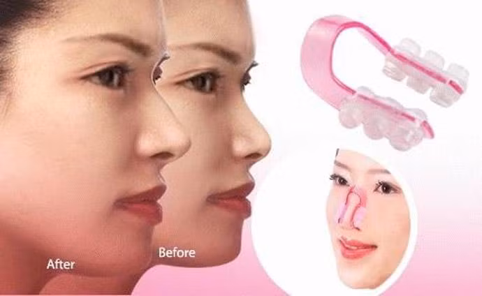 Xuất phát từ Nhật Bản, dụng cụ nâng mũi này rất được ưa chuộng tại Châu Á.