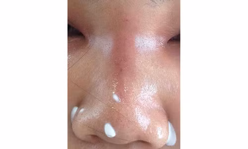 Nhan nhan quang cao nang mui gia sieu re tu 1,5 trieu dong-Hinh-3