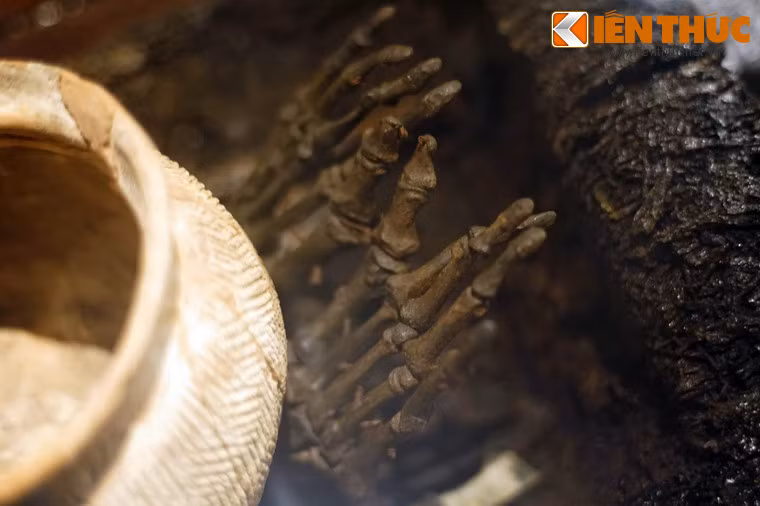 Xương bàn chân của người đã khuất.