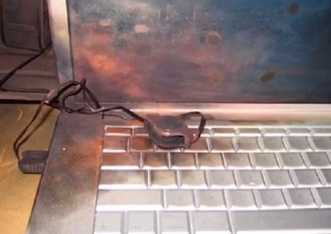 Bé trai 8 tuổi bị bỏng nặng do laptop phát nổ Be trai 8 tuoi bi bong nang do laptop phat no