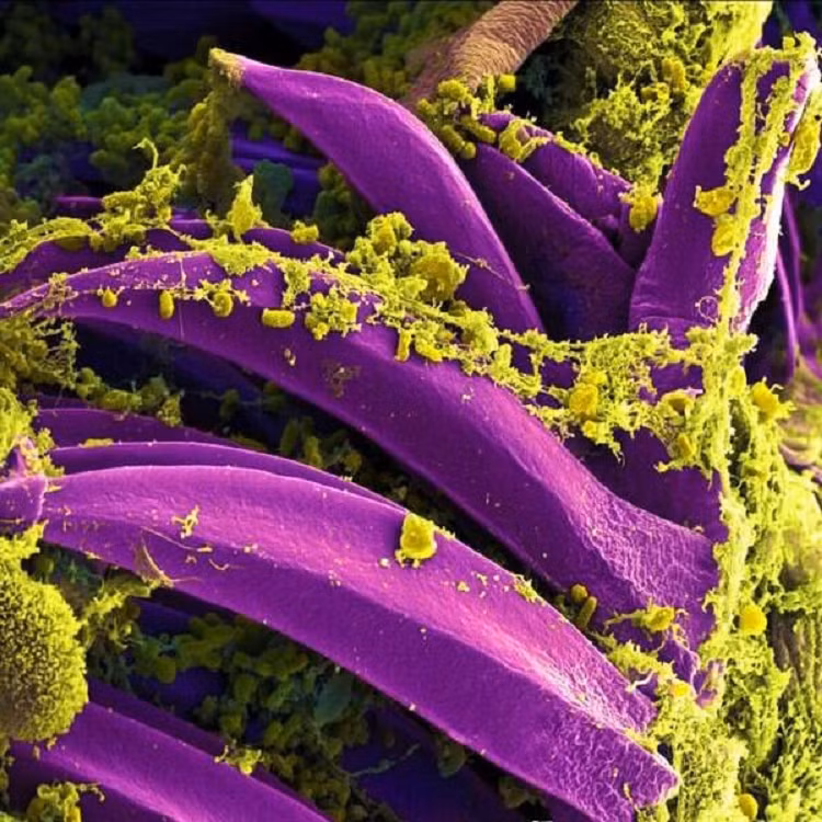 Yersinia pestis - vi khuẩn gây ra bệnh dịch hạch, trên gai của bọ chét. 