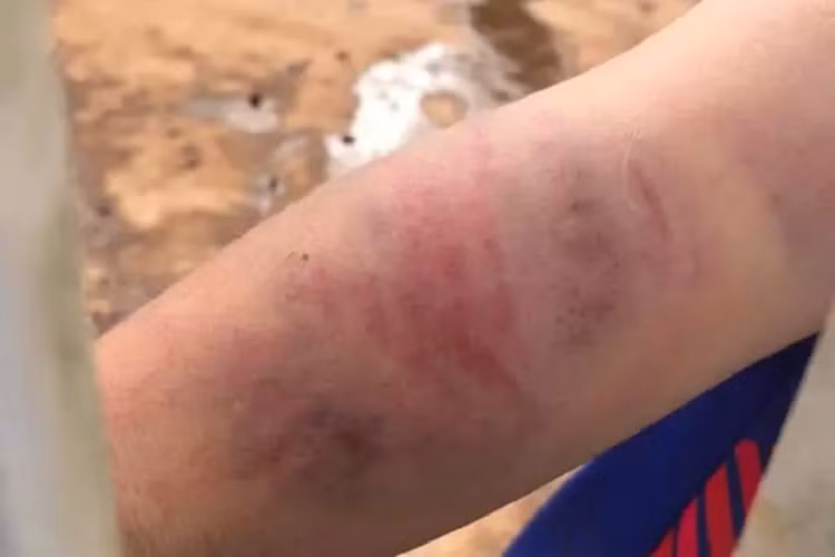 Be trai 9 tuoi bi bo va ba noi danh dap kinh hoang-Hinh-2