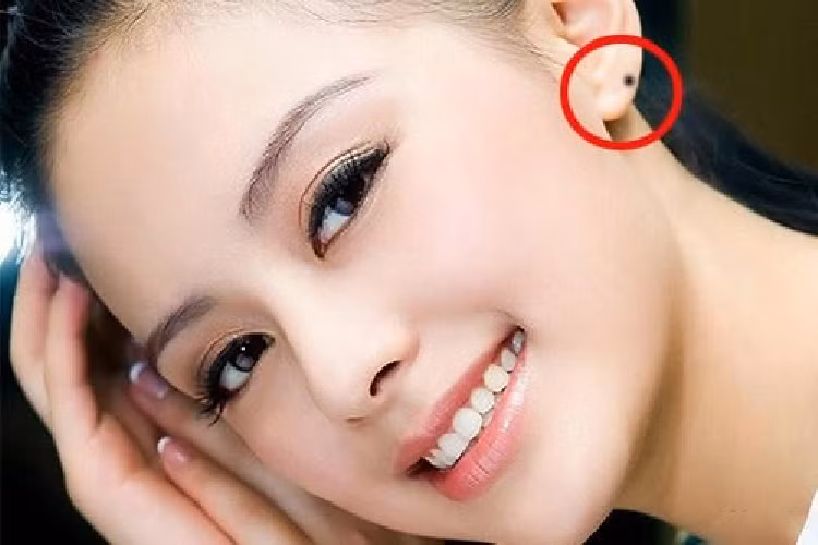 Nốt ruồi trên tai hoặc thùy tai. Bạn có phúc khí, trường thọ và tài vận tốt. Vành tai có nốt ruồi thì thông minh hiếu thuận, mặt sau tai có nốt ruồi thì tiềm lực tài chính lớn. Ảnh: pinterest