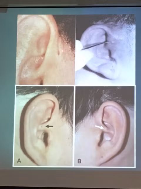 Hy hữu: cụ ông 73 tuổi phải nhập viện khoa Nhi điều trị - Hình 2 Hy huu: cu ong 73 tuoi phai nhap vien khoa Nhi dieu tri-Hinh-2