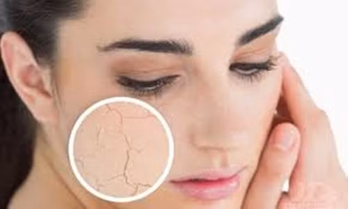 Lúc này, bạn phải chọn riêng từng sản phẩm làm đẹp vừa cung cấp đủ nước lại vừa giúp làn da được sưởi ấm đến từng tế bào lại vừa khiến cho bạn siêng làm đẹp.