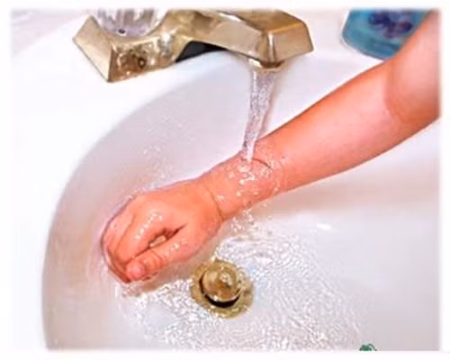 Phòng bệnh, nên mặc quần áo ấm nhiều lớp, đặc biệt nếu ra ngoài trời lâu. Luôn giữ quần áo khô ráo bởi quần áo ẩm sẽ tăng nguy cơ mất nhiệt. Nếu nhận thấy tê cóng, hãy vào phòng ấm càng sớm càng tốt. Hãy ngâm vùng da tổn thương trong nước ấm và tránh cọ rửa hay massage vùng da bị thương tổn.