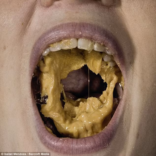 Chứng "sợ bơ lạc dính vào miệng" (Arachibutyrophobia). Bạn có thể cảm thấy ngạc nhiên, thậm chí thấy hơi ngớ ngẩn khi nghe cái tên trên, nhưng căn bệnh này là có thật. Đối với những người mắc bệnh, việc ăn một chiếc bánh nhân bơ lạc là một thử thách khủng khiếp bởi họ rất sợ cảm giác bơ lạc dính trong miệng.