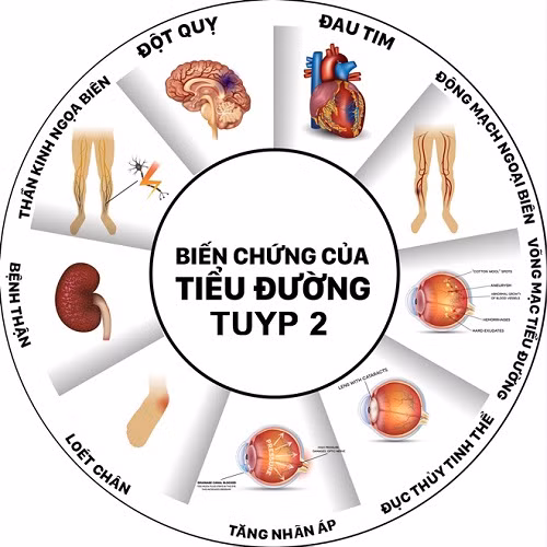 Can benh cu 10 giay chet mot nguoi, 70% dan so chua duoc chan doan