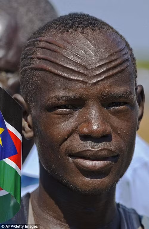 Một người đàn ông thuộc khu vực Abyei của Sudan với những vết sẹo đều trán của ông, những vết sẹo này được tạo ra trong một nghi thức truyền thống của dân tộc. (Nguồn Dailymail)