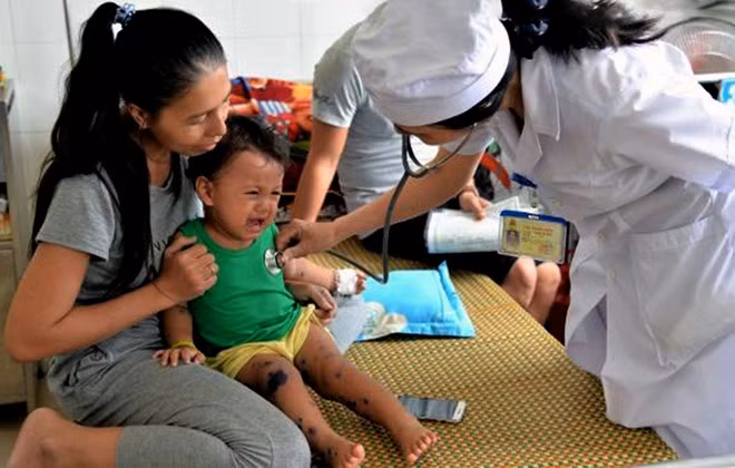 Quảng Ngãi: Trẻ mắc tay chân miệng nhập viện tăng đột biến - Hình 2 Quang Ngai: Tre mac tay chan mieng nhap vien tang dot bien-Hinh-2