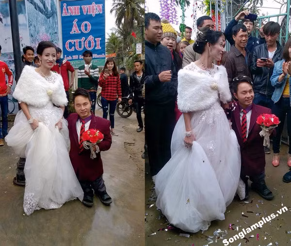 Thời gian trước trên mạng xã hội cũng rầm rộ chia sẻ những bức hình đón dâu tại miền quê nghèo Nghệ An. Cặp đôi chồng tí hon vợ khổng lồ hạnh phúc nắm tay nhau trong con mắt tò mò của những người xung quanh, chú rể có thân hình thấp nhỏ, chỉ cao bằng đứa trẻ 5 tuổi trong khi cô dâu cao lớn đứng bên.
