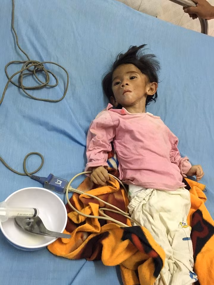 Những ngày vừa qua, hoàn cảnh của bé Thào Thị Yến Nhi, sinh ra ở bản Cát Cát, huyện Sa Pa, Lào Cai là câu chuyện được cộng đồng rất quan tâm. Hình ảnh em bé 14 tháng tuổi nặng 3,5kg do bị mẹ bỏ rơi, bố vụng về không biết chăm nom dẫn đến tình trạng bị suy dinh dưỡng nặng, người gầy trơ xương... đã lấy đi không ít nước mắt của những người có trái tim nhân hậu.