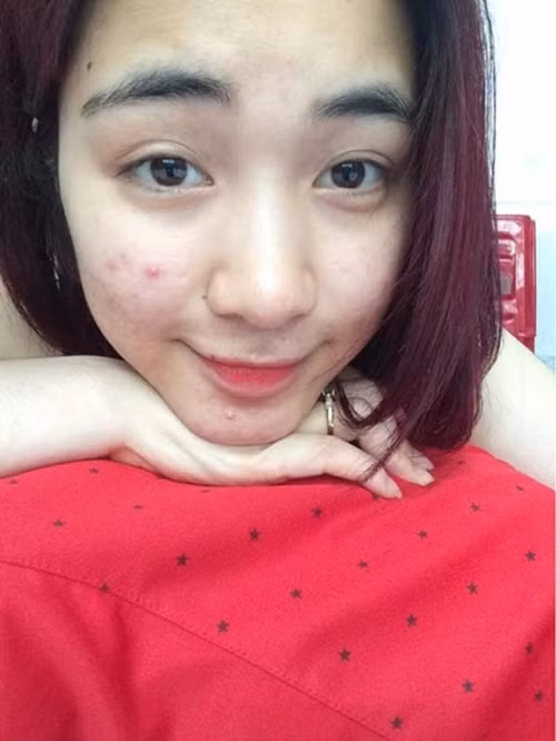 Hòa Minzy sở hữu gương mặt ưa nhìn. Trong một thời gian khá dài, cô khổ sở vì làn da nhạy cảm, nổi mụn. Giọng ca Rời bỏ đã cải thiện làn da bằng mỹ phẩm, chế độ ăn uống, chăm sóc da. Ảnh: Dân Việt.