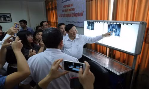 Xử lý tắc vòi tử cung đoạn kẽ cho phụ nữ vô sinh Xu ly tac voi tu cung doan ke cho phu nu vo sinh