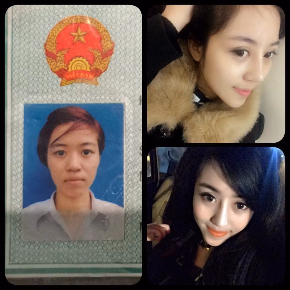 Một bà mẹ 9X tên là Đào Minh Châu mới đây chia sẻ với bạn bè, dân mạng câu chuyện cô làm phẫu thuật thẩm mỹ cả mặt, lột xác hoàn toàn để trở nên thật xinh đẹp, để tận hưởng cuộc sống theo một cách hoàn toàn khác.