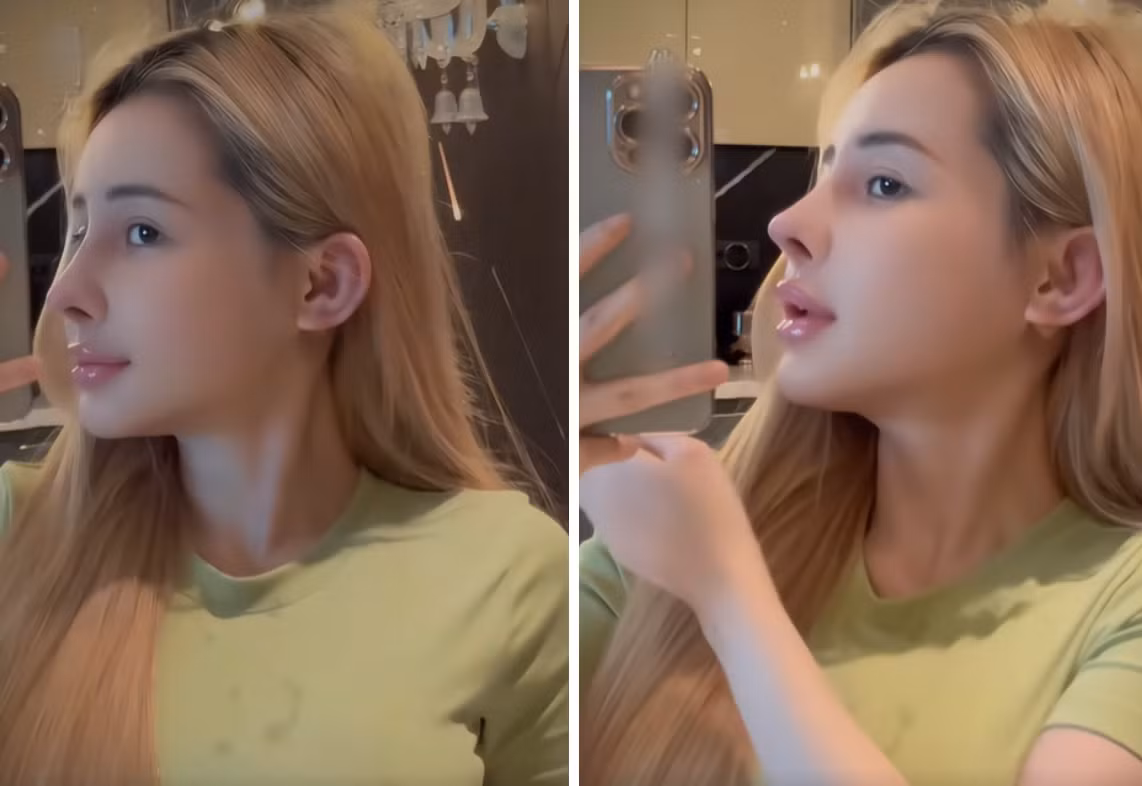 Hồi tháng 7, cô cũng từng sang Hàn Quốc và mạnh tay chi hàng trăm triệu đồng để chỉnh sửa nhiều đường nét trên gương mặt, bao gồm mũi, môi, cằm và gò má. Ảnh chụp màn hình