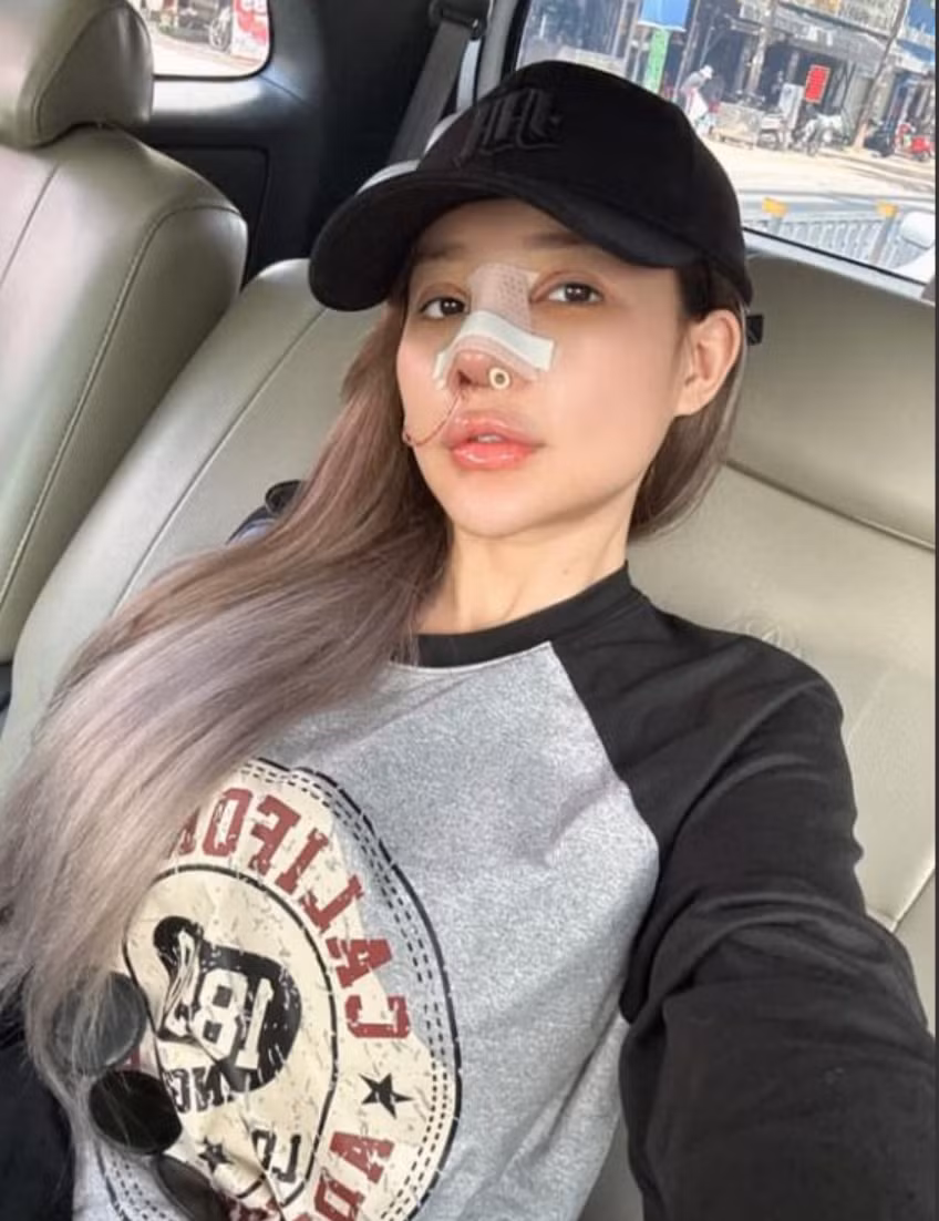 Tuy nhiên, cũng có không ít ý kiến trái chiều, cho rằng chiếc mũi của nữ DJ Ngân 98 đã bị biến dạng, mất đi vẻ tự nhiên. Ảnh: FB DJ NGÂN 98