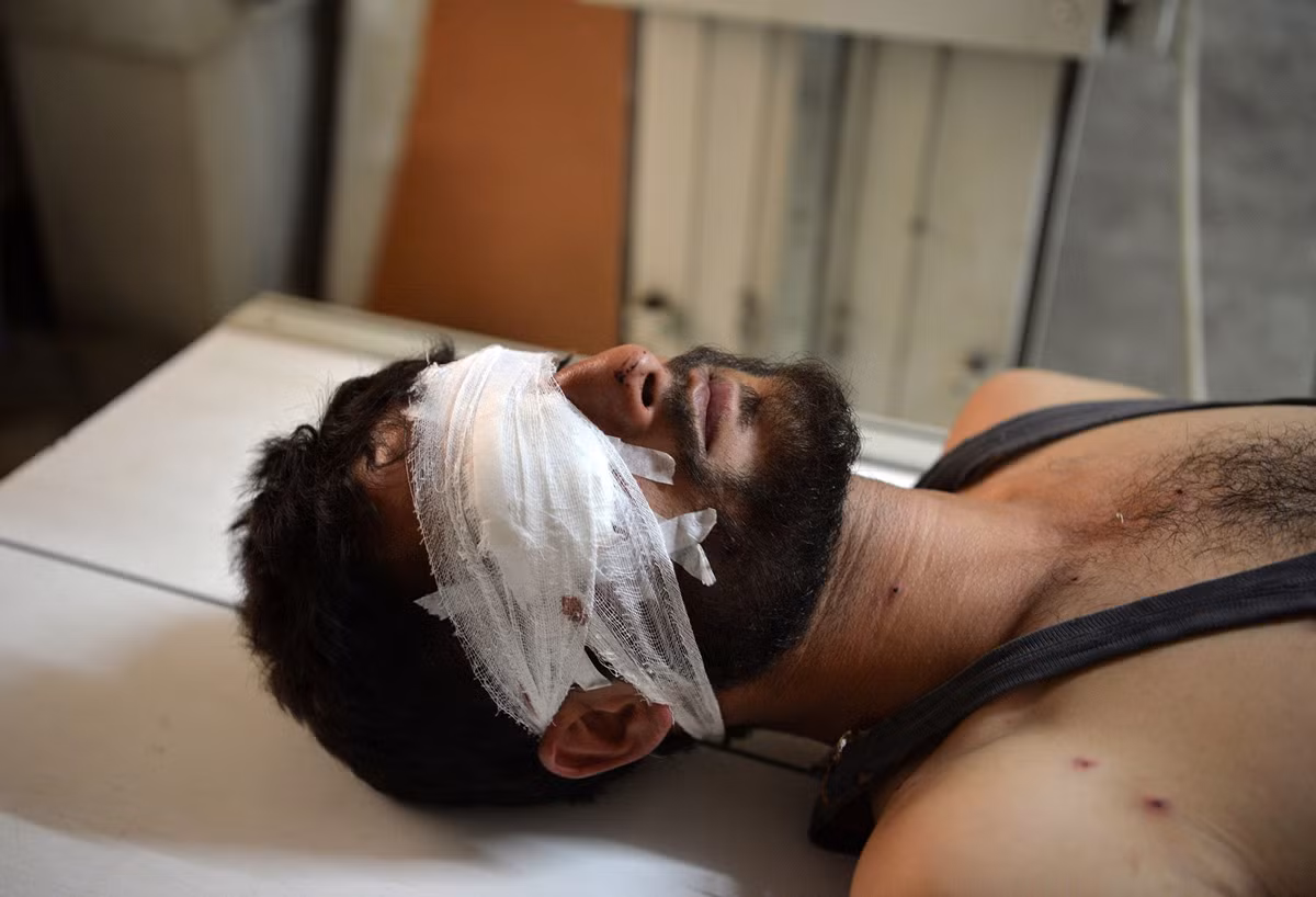 Một sinh viên Kashmir bị thương đang được điều trị tại bệnh viện ở Srinagar hôm 15/4. Ảnh: The Atlantic.