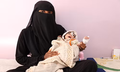 Nhiều đứa trẻ Yemen đang chết dần vì nạn đói và tình trạng suy dinh dưỡng cấp tính. Ảnh: AJ.