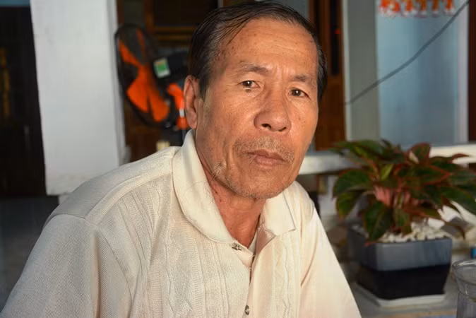 Viet kieu bi tat axit, cat gan chan: Hanh dong la cua anh trai