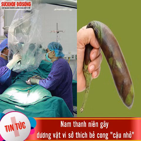 Những tai nạn 'cậu nhỏ' khó đỡ nhất trong thời gian vừa qua - Hình 4 Nhung tai nan 'cau nho' kho do nhat trong thoi gian vua qua-Hinh-4