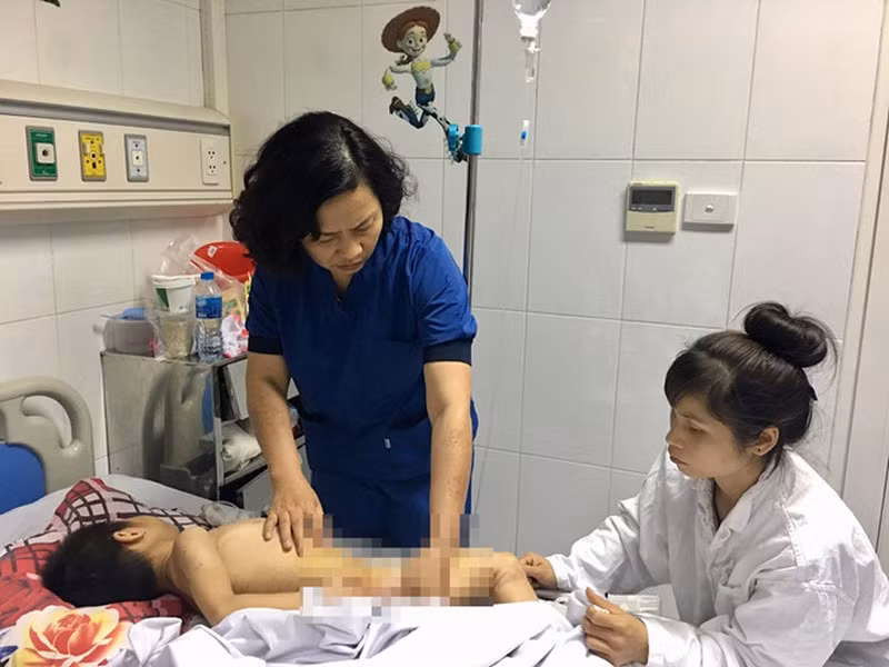 Xot xa nhung truong hop tre nho bi cho can ton thuong nghiem trong-Hinh-4