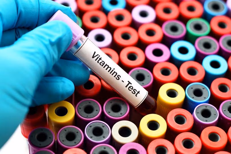Thiếu vitamin: Thiếu vitamin B12 có thể gây thiếu máu ác tính - một bệnh tự miễn. Bệnh này thường do chế độ ăn thiếu vitamin B, hoặc do cơ thể mắc các bệnh về tiêu hóa dẫn đến không thể hấp thu các vitamin từ thực phẩm.