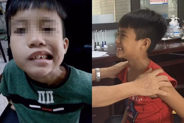 Sử dụng điều hòa thế nào để tránh bị méo miệng, lệch mặt Su dung dieu hoa the nao de tranh bi meo mieng, lech mat