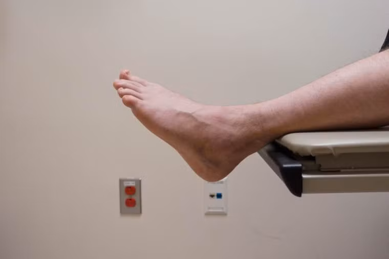 Bàn chân và chân của bạn bị sưng: Nếu bạn nhận thấy đột nhiên chân mình khó đút vào giày hoặc đeo tất thấy chật, đó có thể là một trong những dấu hiệu của bệnh tim.