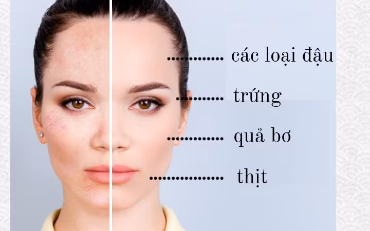 Da khô: Khi bạn thiếu cholesterol và dư thừa vitamin E trong cơ thể, da bạn sẽ bị khô. Do đó, hãy tăng axit béo không bão hòa trong chế độ ăn uống. Bạn có thể thêm đậu, trứng, đậu nành, bơ, đậu phộng và các loại hạt khác vào thực đơn của mình.