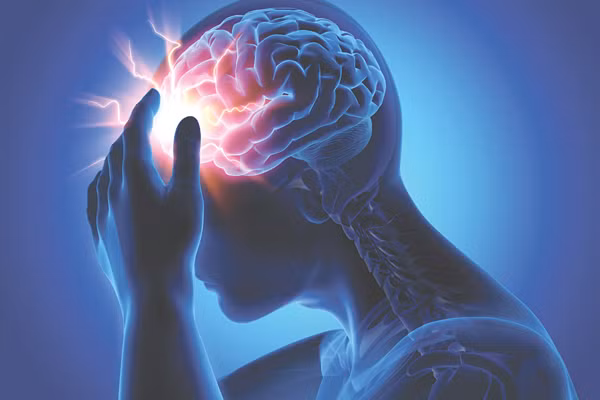 Nam sinh 17 tuổi hôn mê sau đau đầu: Báo động tình trạng đột quỵ ở người trẻ Nam sinh 17 tuoi hon me sau dau dau: Bao dong tinh trang dot quy o nguoi tre