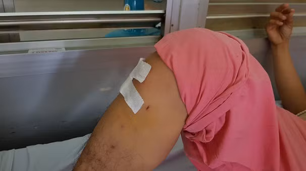 Benh nhan gay xuong nguc bi khoan chan: Ap luc khien bac si nham?