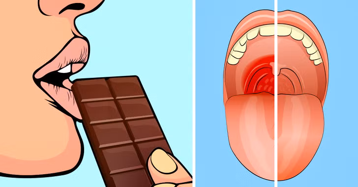 Ăn một miếng socola đen để làm dịu cơn đau họng: Nếu bạn bị ho và bạn cảm thấy cổ họng bị đau, hãy ăn một miếng socola đen chứa một lượng lớn ca cao trong đó. Theo các nhà khoa học, socola có thể ức chế ho, giảm đau và chữa viêm họng thậm chí còn tốt hơn các phương thuốc thông thường.