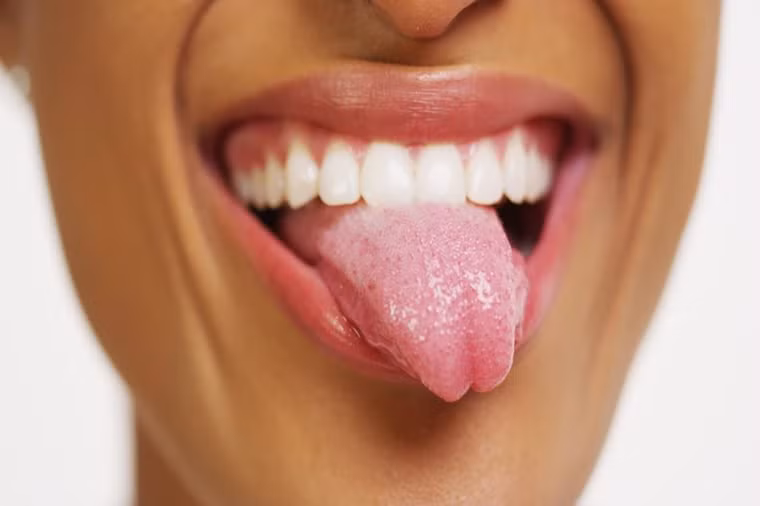 Lưỡi: Vùng lưỡi có cấu tạo phức tạp nên vi khuẩn hoặc thức ăn thừa sẽ dễ tích tụ lại khiến hơi thở bốc mùi, thậm chí là hư hại răng. Do vậy, nên chú ý chà sạch lưỡi nhẹ nhàng khi chải răng.