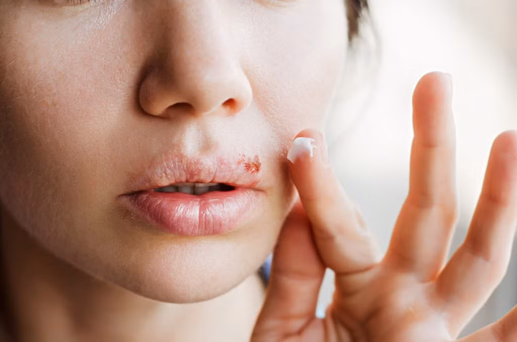 Thứ hai, bảo vệ răng. Các nghiên cứu hiện đại chứng minh, nước bọt là một rào cản tự nhiên để duy trì sức khỏe răng miệng và có thể ngăn ngừa và làm giảm sự xuất hiện của sâu răng. Sâu răng chủ yếu do vi khuẩn phân hủy đường còn sót lại trong miệng tạo ra axit, chất này từ từ ăn mòn răng.