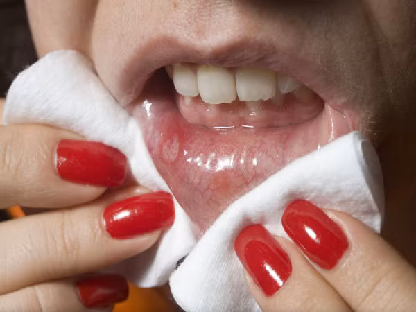 Thứ tư, khử trùng và khử độc. Nước bọt có tác dụng chống viêm, giảm đau, khử trùng và giải độc. Ở châu Á, nước bọt thường được dùng để bôi lên những chỗ sưng tấy đỏ bị muỗi đốt. Đó là do trong nước bọt có tiết ra immunoglobulin A và lysozyme, có khả năng kháng lại và diệt vi khuẩn.