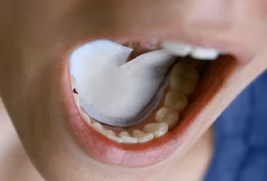 Dòng chảy của nước bọt rất quan trọng đối với việc ngăn ngừa các bệnh răng miệng. Nếu lượng nước bọt tiết ra không đủ, thức ăn trong miệng không thể được rửa trôi, chúng ở lại khoang miệng, lâu ngày dễ gây viêm lợi.