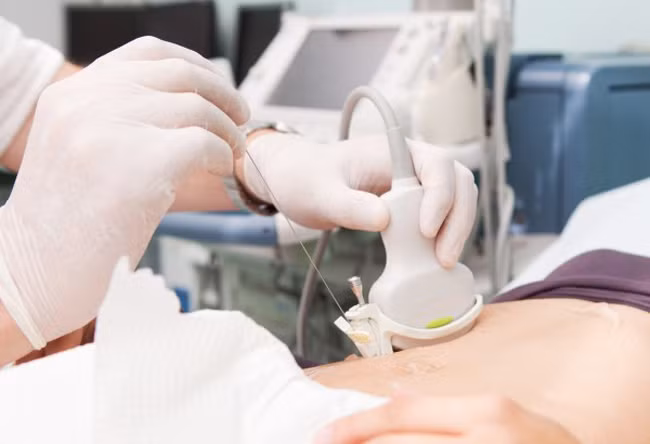 3. Vàng da: Nếu ung thư gan phát triển gần ống mật và xâm lấn vào ống gan chung hoặc ống mật chủ, mật khó lưu thông thì hiện tượng vàng da có thể xảy ra.