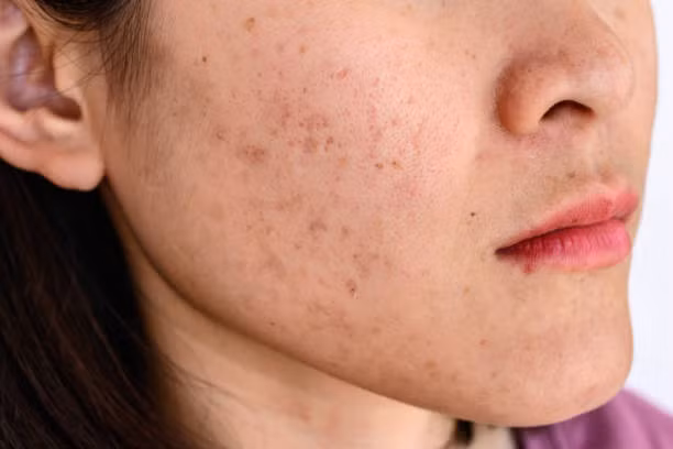 Chính vậy, một người có khỏe mạnh hay thân mình đầy bệnh tật, chỉ cần nhìn sắc mặt là có thể đoán biết. Sắc mặt được xem là nơi "báo cáo" tình hình sức khỏe lục phủ ngũ tạng của một người, phản chiếu những mối nguy tiềm tàng bên trong cơ thể.