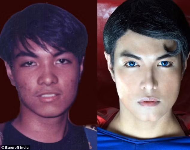 18 nam phau thuat tham my de giong superman-Hinh-7