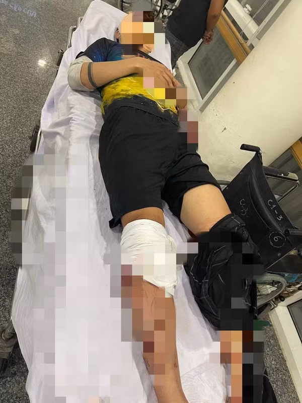  Mâu thuẫn trong lúc đá bóng, một thanh niên bị chém gục: Chiều 17/11/2021, anh Trần Văn K. (22 tuổi) cùng nhóm bạn đến sân bóng ở ấp 6, xã Bình Mỹ (TPHCM) để đá bóng. Trong lúc đá bóng, hai bên xảy ra mâu thuẫn nhỏ. Khi trận đấu kết thúc, đội bạn ra về còn anh K. cùng bạn ngồi lại uống nước thì bất ngờ có một nhóm thanh niên cầm hung khí từ ngoài tới lao vào tấn công. Anh K. bị chém gục tại chỗ, được đưa đi cấp cứu trong tình trạng vỡ xương sọ, đứt hai gân chân, nhiều vết chém sâu ở cơ thể. 
