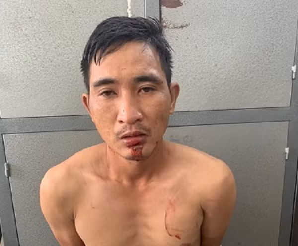 Hải Dương: Hai tên cướp tiệm vàng, bắn trưởng công an xã đã bị bắt - Hình 2 Hai Duong: Hai ten cuop tiem vang, ban truong cong an xa da bi bat-Hinh-2