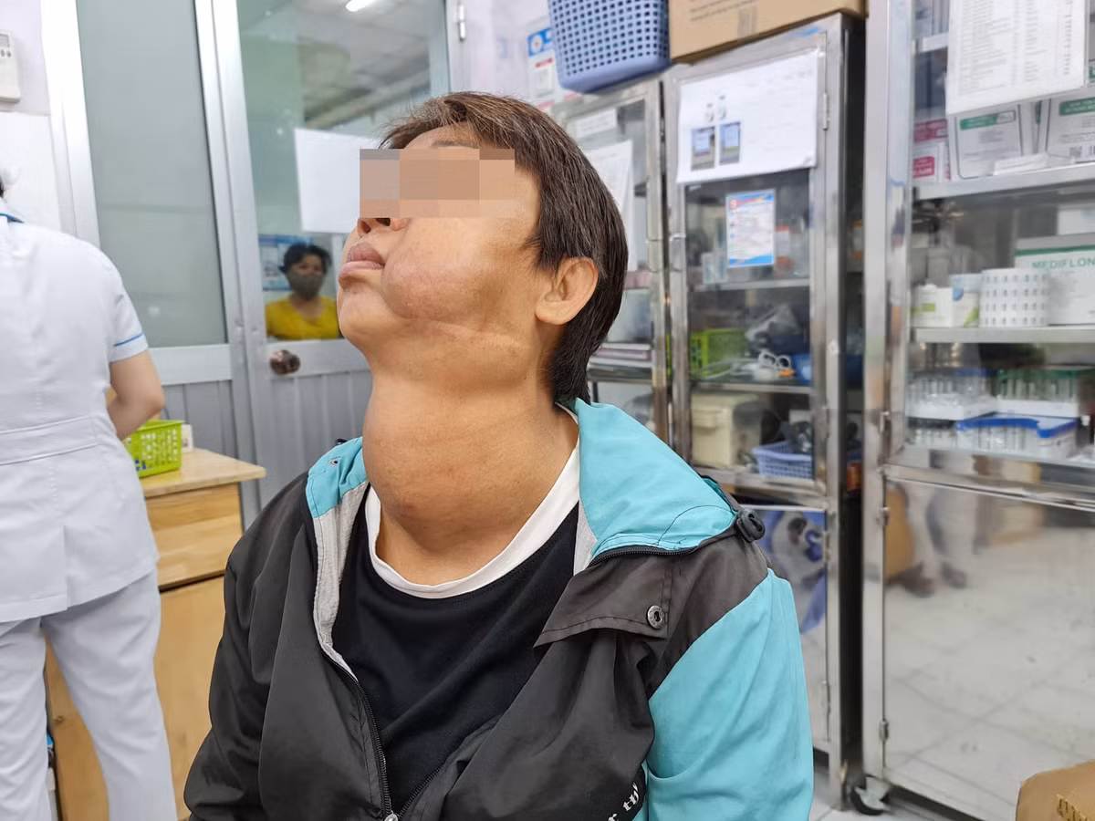 U lon tuyen giap ket hop u mau day khi quan va thuc quan sang phai